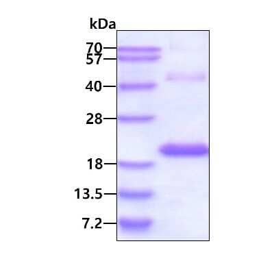 SDS-PAGE: Recombinant Human SNIP1 His Protein [NBP1-72317]